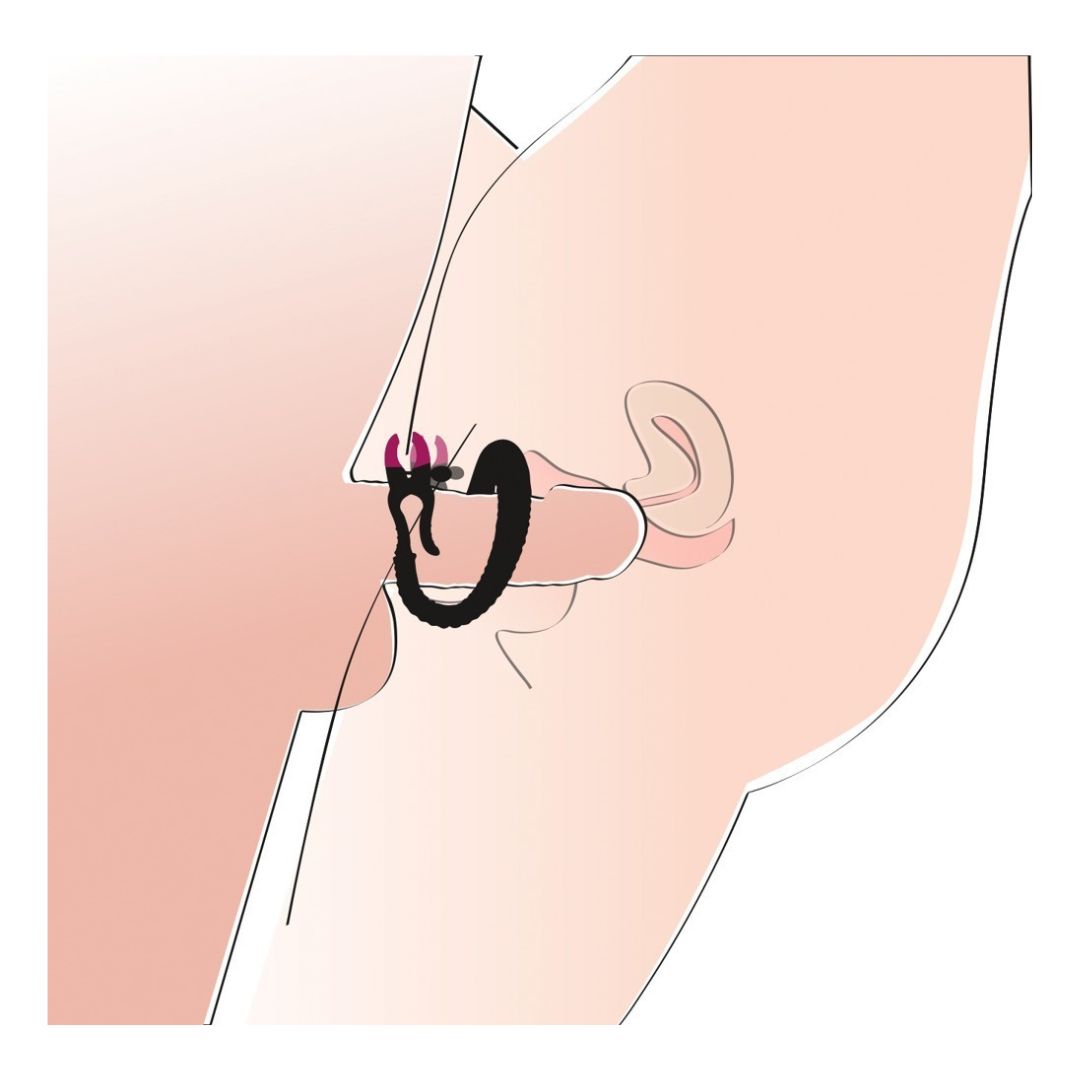 Vulvalippenspreizer mit Klemmen - OH MY! FANTASY
