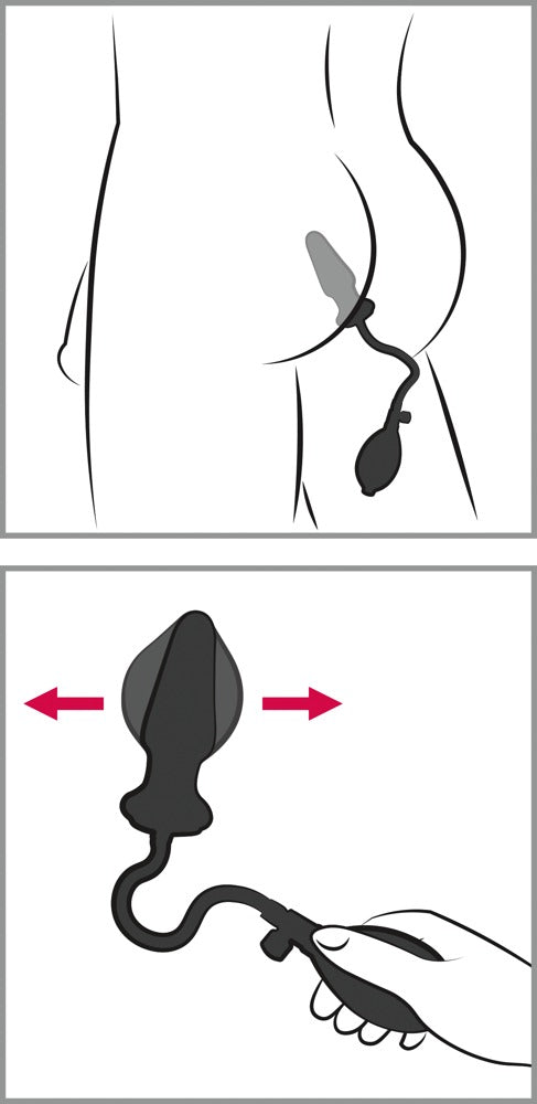 You2Toys - Anal-Expert - Latex-Analzapfen