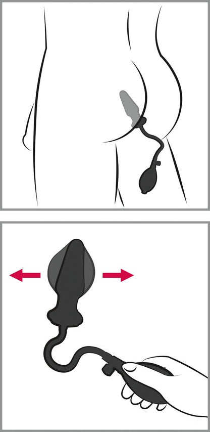 You2Toys - Anal-Expert - Latex-Analzapfen