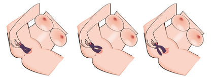 Elegant Series - Elegant Vibrator Double Vibe
